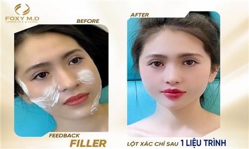 Feedback Filler Tại Foxy: Trải Nghiệm Thực Tế Từ Khách Hàng