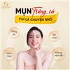 Điều trị mụn