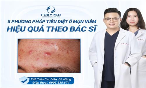 5 PHƯƠNG PHÁP TIÊU DIỆT Ổ MỤN VIÊM HIỆU QUẢ THEO BÁC SĨ