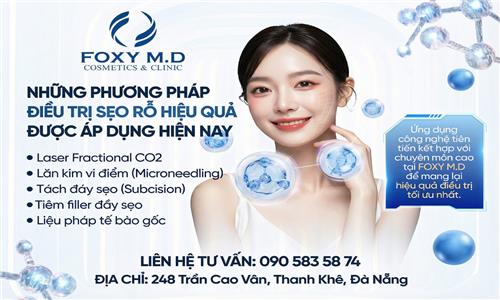 Sẹo rỗ là gì? Nguyên nhân và cách điều trị hiệu quả