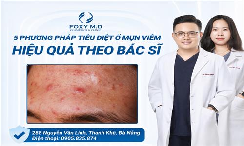 5 PHƯƠNG PHÁP TIÊU DIỆT Ổ MỤN VIÊM HIỆU QUẢ THEO BÁC SĨ