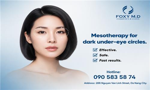 Mesotherapy for dark circles under the eyes in Da Nang: The solution to 