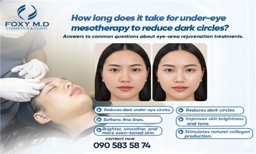 How Long Does It Take for Dark Circles Under Eyes to Disappear in Da Nang? Expert Answers