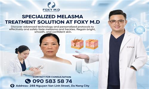 Advanced Melasma Treatment Solutions at Foxy MD