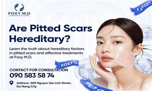Are pitted scars hereditary in Da Nang? The truth few people know.