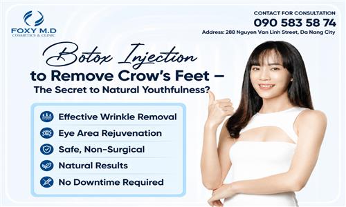Botox injections for crow's feet - The secret to natural youthfulness