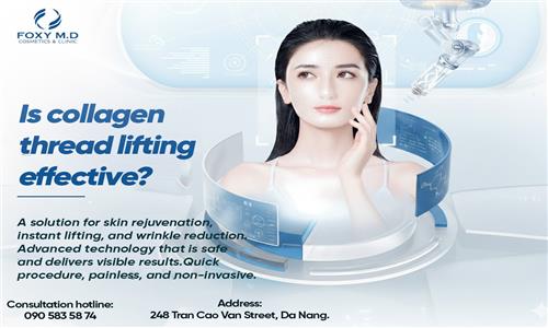 Căng Chỉ Collagen Có Hiệu Quả Không? Giải Mã Sự Thật Về Phương Pháp Trẻ Hóa 