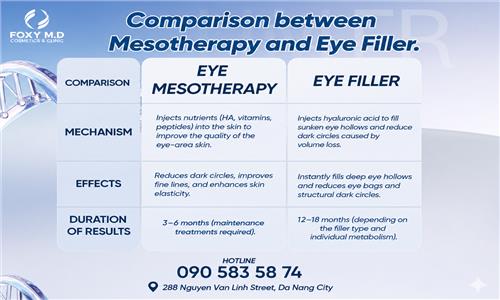 Comparing Mesotherapy and Eye Fillers: Which is the Solution for Dark Circles?