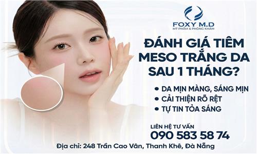 Đánh giá tiêm meso trắng da sau một tháng có tốt không?