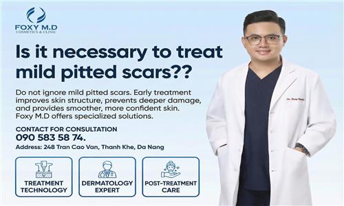 Do Mild Acne Scars Need Treatment? A Detailed Explanation