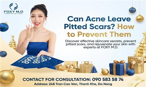 Does Acne Leave Scars? Effective Prevention Methods