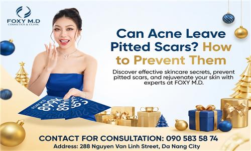 Does Acne Leave Scars? Effective Prevention Methods