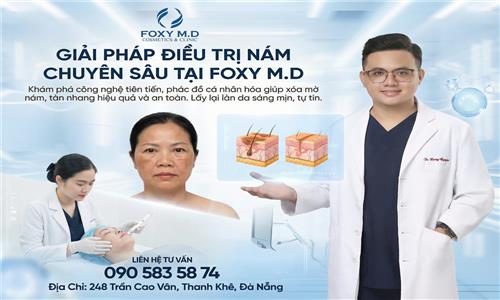 Giải pháp điều trị nám chuyên sâu tại Foxy MD