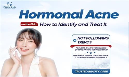 HORMONAL ACNE ON THE CHIN: RECOGNITION AND MEDICALLY STANDARDIZED SOLUTIONS IN DA NANG