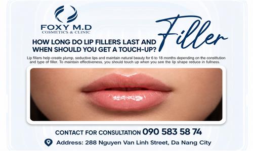 How Long Do Lip Fillers Last and When Should You Get a Touch-Up?