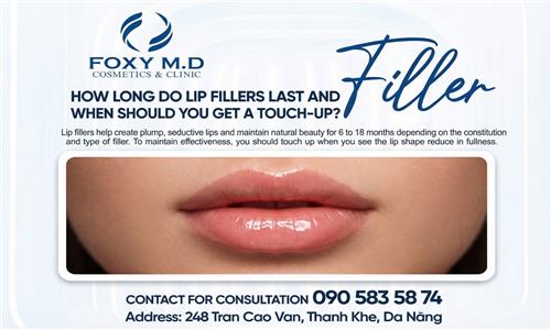 How Long Do Lip Fillers Last and When Should You Get a Touch-Up?