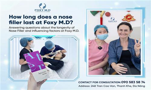 How long does nose filler last at Foxy MD? Answers from experts
