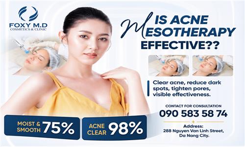 Is acne mesotherapy effective? The secret to smooth skin from the root