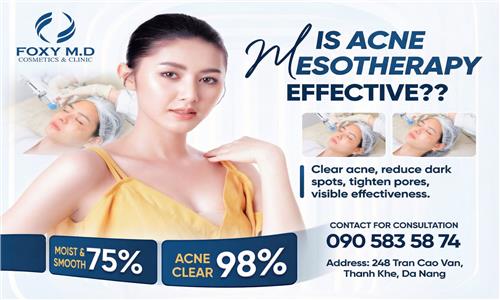 Is acne mesotherapy effective? The secret to smooth skin from the root