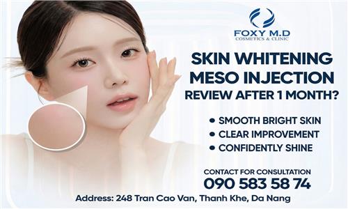 Is Skin-Whitening Mesotherapy Effective After One Month?