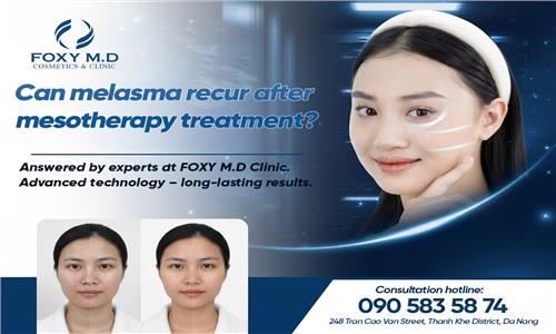 Meso trị nám có tái phát không? Giải đáp cùng chuyên gia Foxy