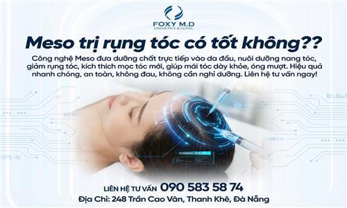 Meso trị rụng tóc có tốt không? Giải đáp chi tiết