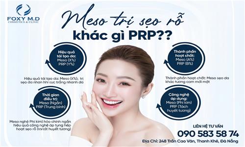 Meso trị sẹo rỗ khác gì PRP? So sánh chi tiết dễ hiểu
