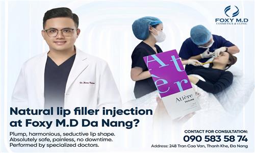 Natural lip filler at Foxy MD Da Nang: Secrets to seductive lips