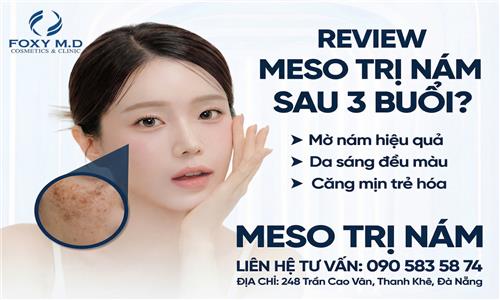 Review meso trị nám sau 3 buổi: Hiệu quả thực tế và những điều cần biết