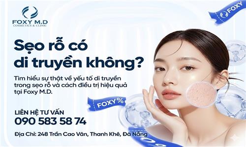 Sẹo Rỗ Có Di Truyền Không Tại Đà Nẵng? Sự Thật Ít Ai Biết
