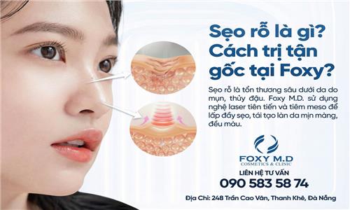 Sẹo rỗ là gì cách trị tận gốc tại foxy? Giải mã từ chuyên gia