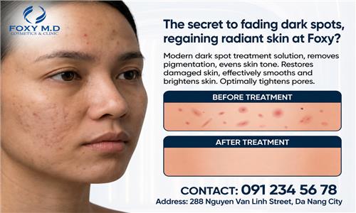 The Secret to Fading Dark Spots and Achieving Radiant Skin at Foxy