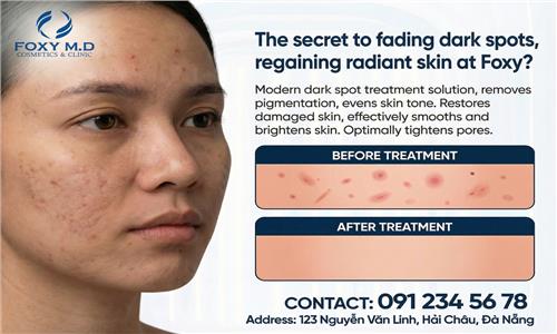 The Secret to Fading Dark Spots and Achieving Radiant Skin at Foxy
