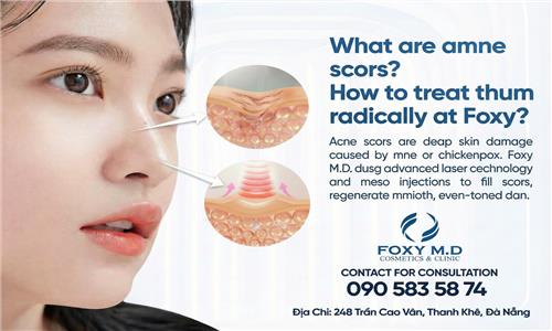 What are pitted scars and how to treat them permanently at Foxy?