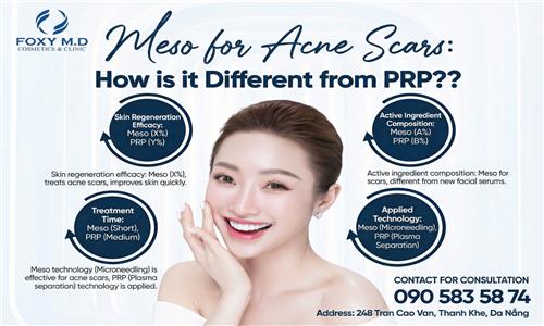 What Is the Difference Between Mesotherapy and PRP for Acne Scar Treatment? A Simple and Detailed Comparison