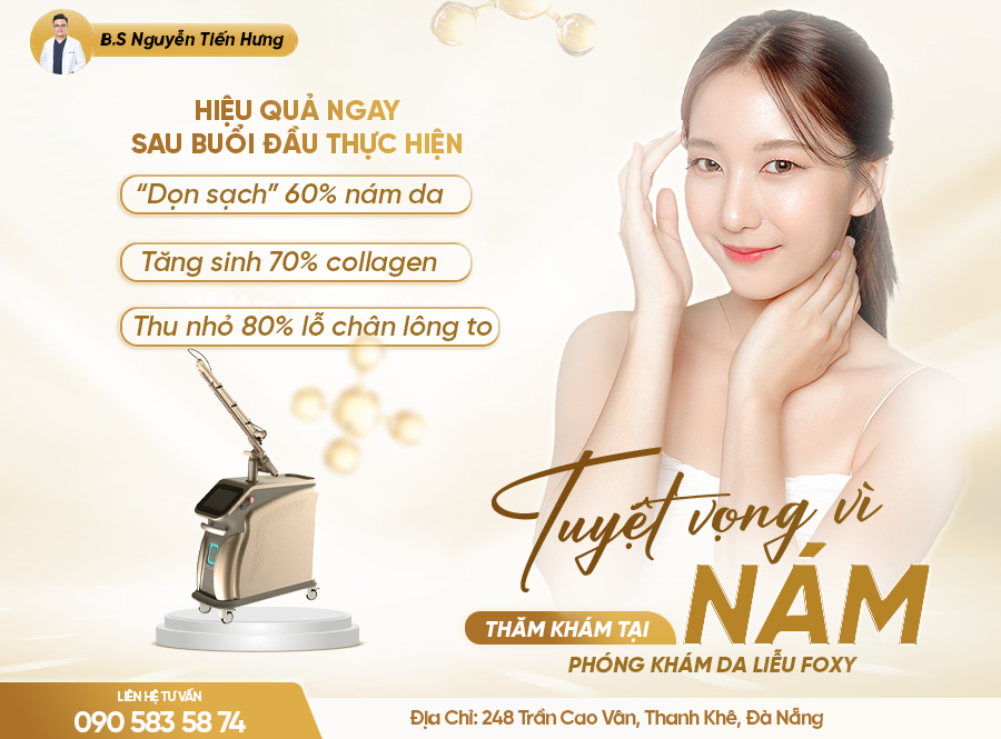 Tuyệt vọng vì nám: Hành trình vượt tối để tìm lại làn da sáng khỏe