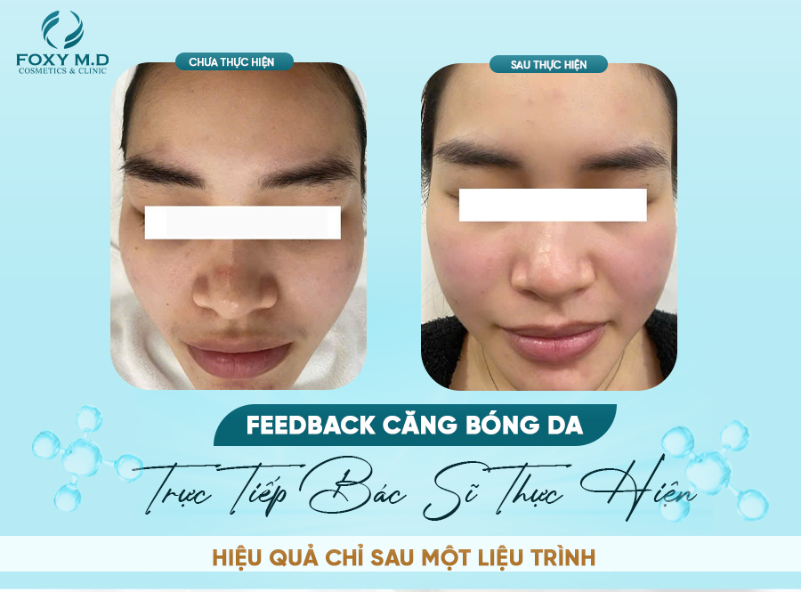 Feedback căng bóng da – Bí quyết da đẹp được nhiều người tin chọn