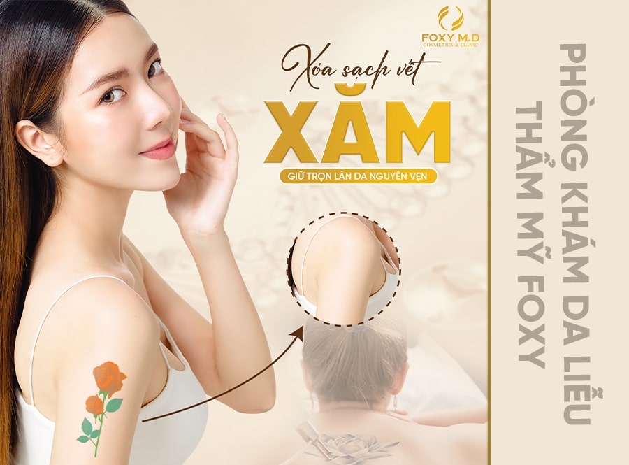 Xóa Hình Xăm Vĩnh Viễn Bằng Laser Tại Đà Nẵng – Lựa Chọn Hiệu Quả và An Toàn