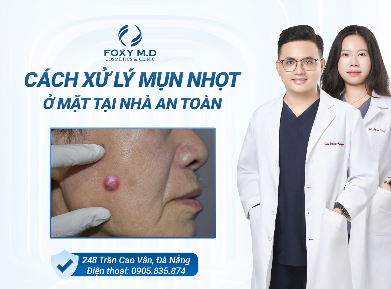 Cách xử lý mụn nhọt ở mặt tại nhà an toàn