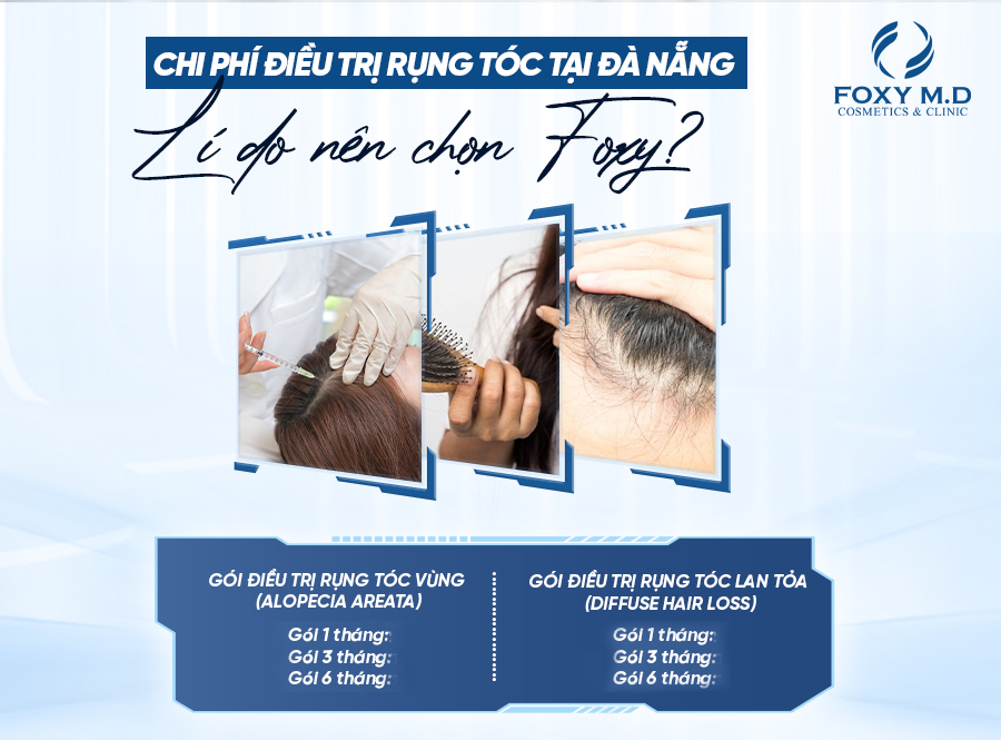 Chi phí điều trị rụng tóc tại Đà Nẵng và lý do nên chọn Foxy M.D?