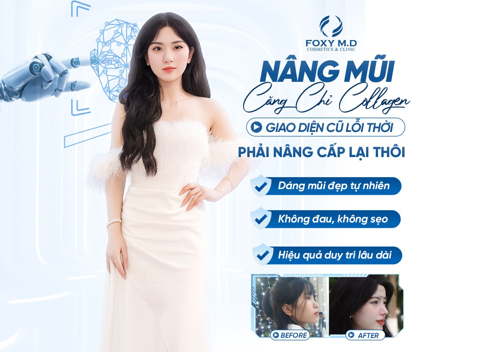 Nâng mũi căng chỉ collagen – Bí quyết dáng mũi đẹp tự nhiên