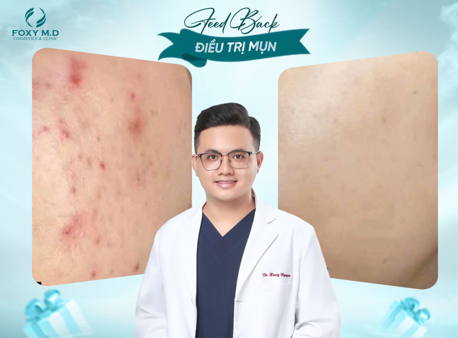 Feedback trị mụn – Lời kể thật từ khách hàng thật