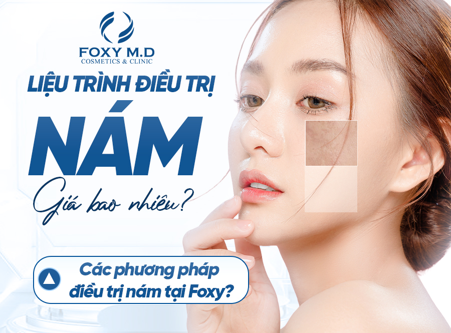 Liệu trình điều trị nám tại Đà Nẵng giá bao nhiêu? Các phương pháp điều trị nám tại Foxy