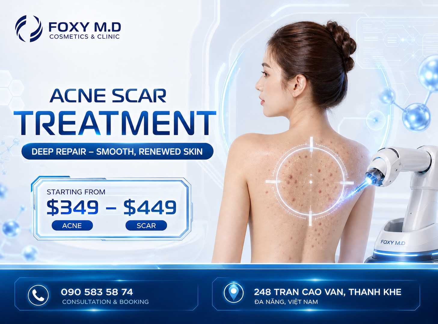 Acne Back Facial in Da Nang — Bacne Control & Anti-Inflammatory Care at Foxy M.D Clinic