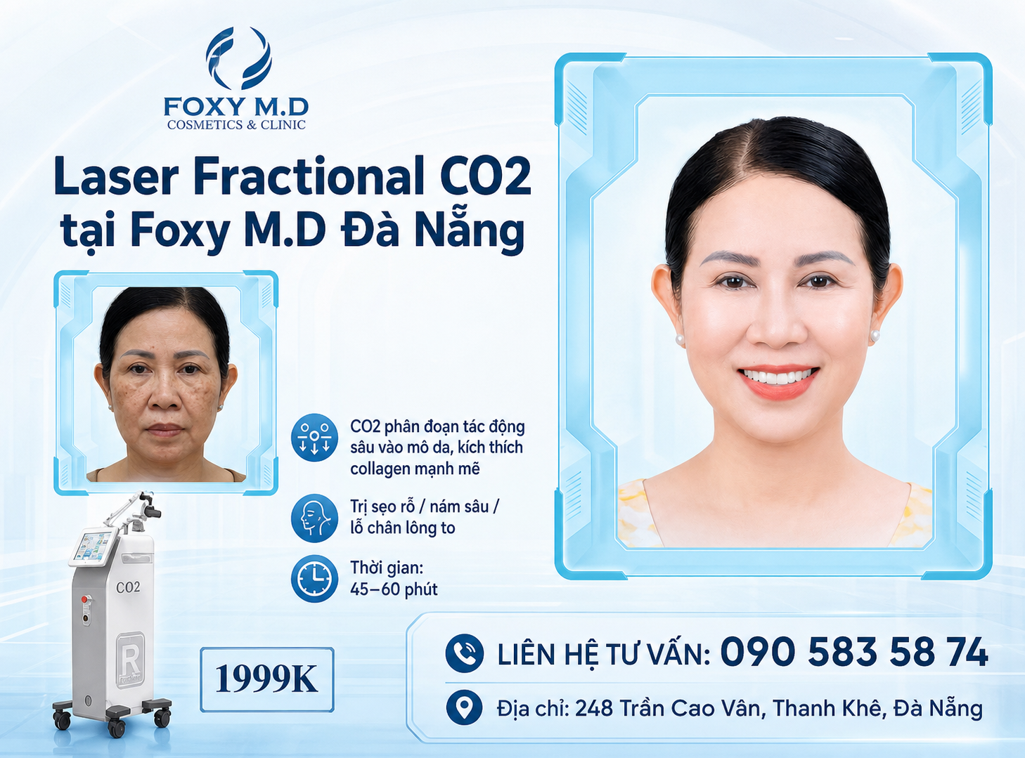 Laser CO2 Fractional Đà Nẵng — Điều Trị Sẹo Rỗ, Lỗ Chân Lông & Nếp Nhăn Chuyên Sâu Tại Foxy M.D Clinic