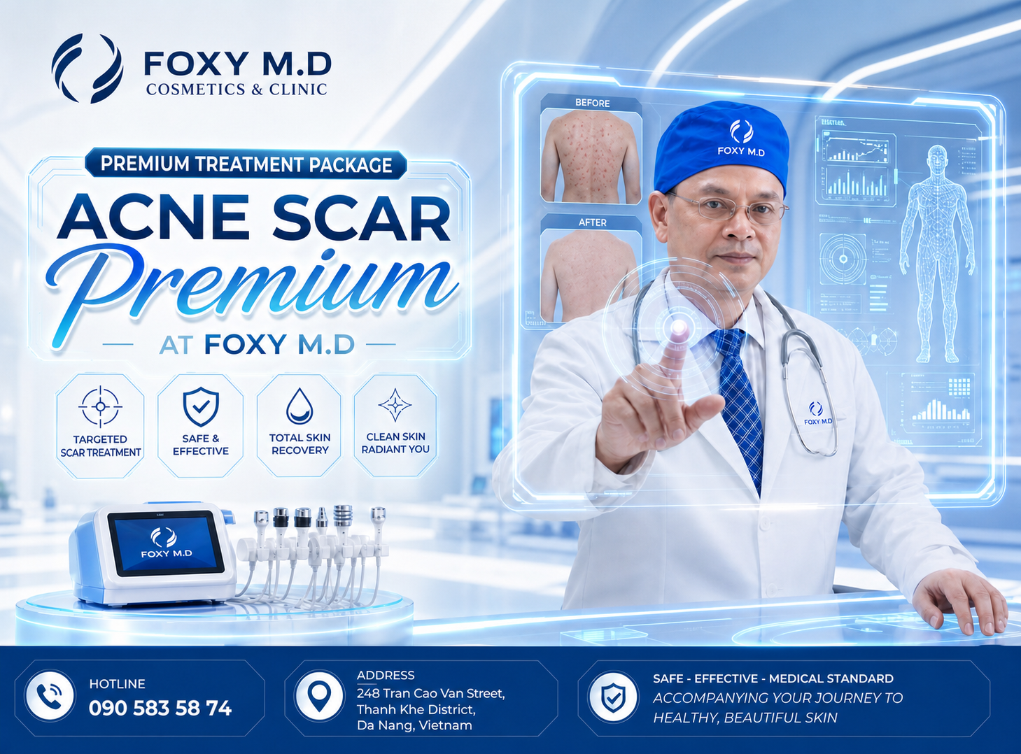 Premium Back Acne Package in Da Nang — Severe Back Acne Treatment with Laser at Foxy M.D Clinic