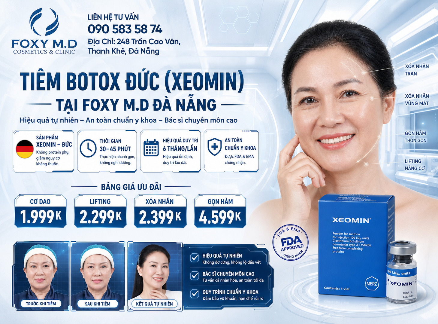Tiêm Botox Đức Xeomin Tại Đà Nẵng – Xóa Nhăn Tinh Khiết Không Protein Phụ