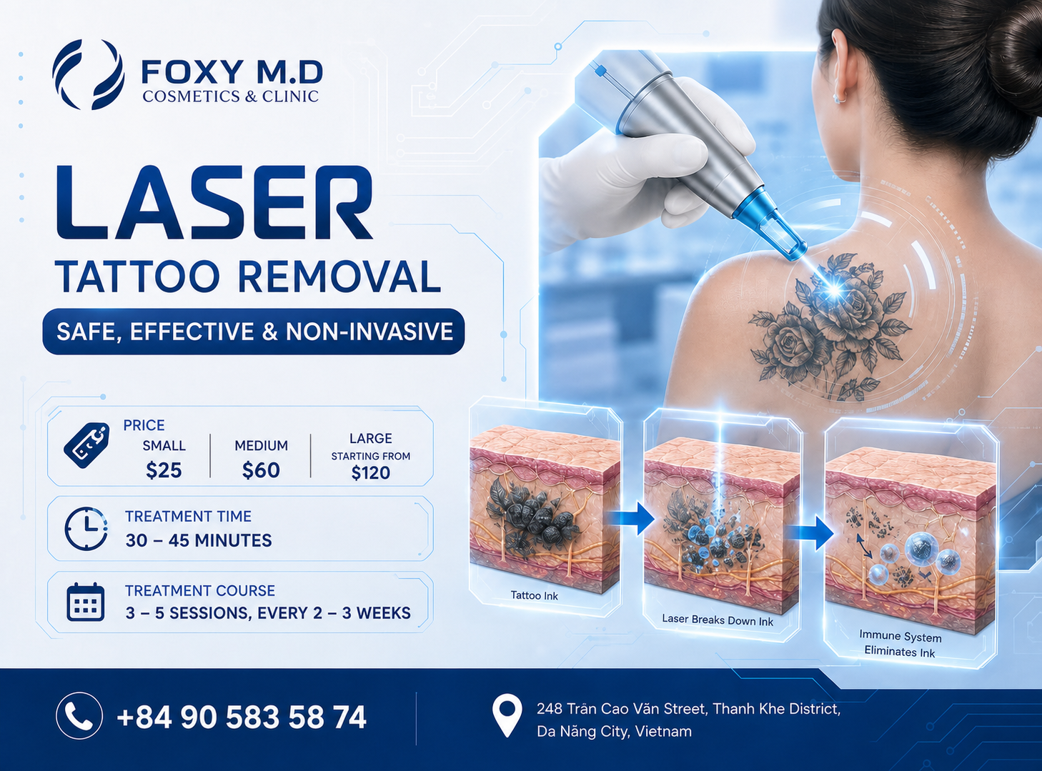 Laser Tattoo Removal in Da Nang — Pico & Q-Switch Technology for Complete Ink Clearance at Foxy M.D Clinic